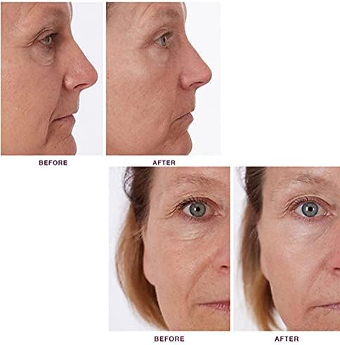 The Ordinary - Hyaluronic Acid 2% + B5 Serum (30ml)