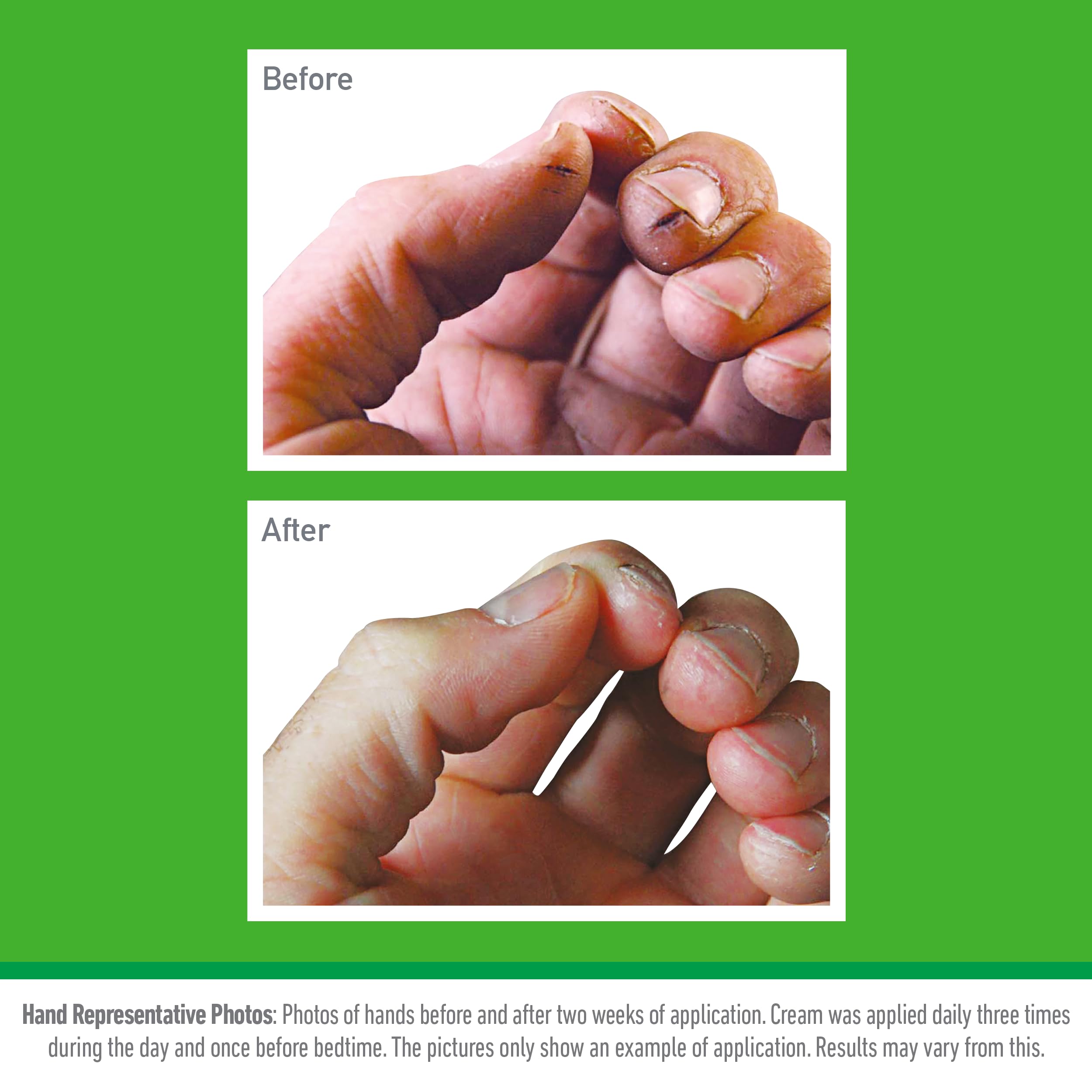 O'Keeffe's Working Hands Hand Cream (193g x 2 Pack) - Non-Greasy Moisturizer for Dry, Cracked Skin