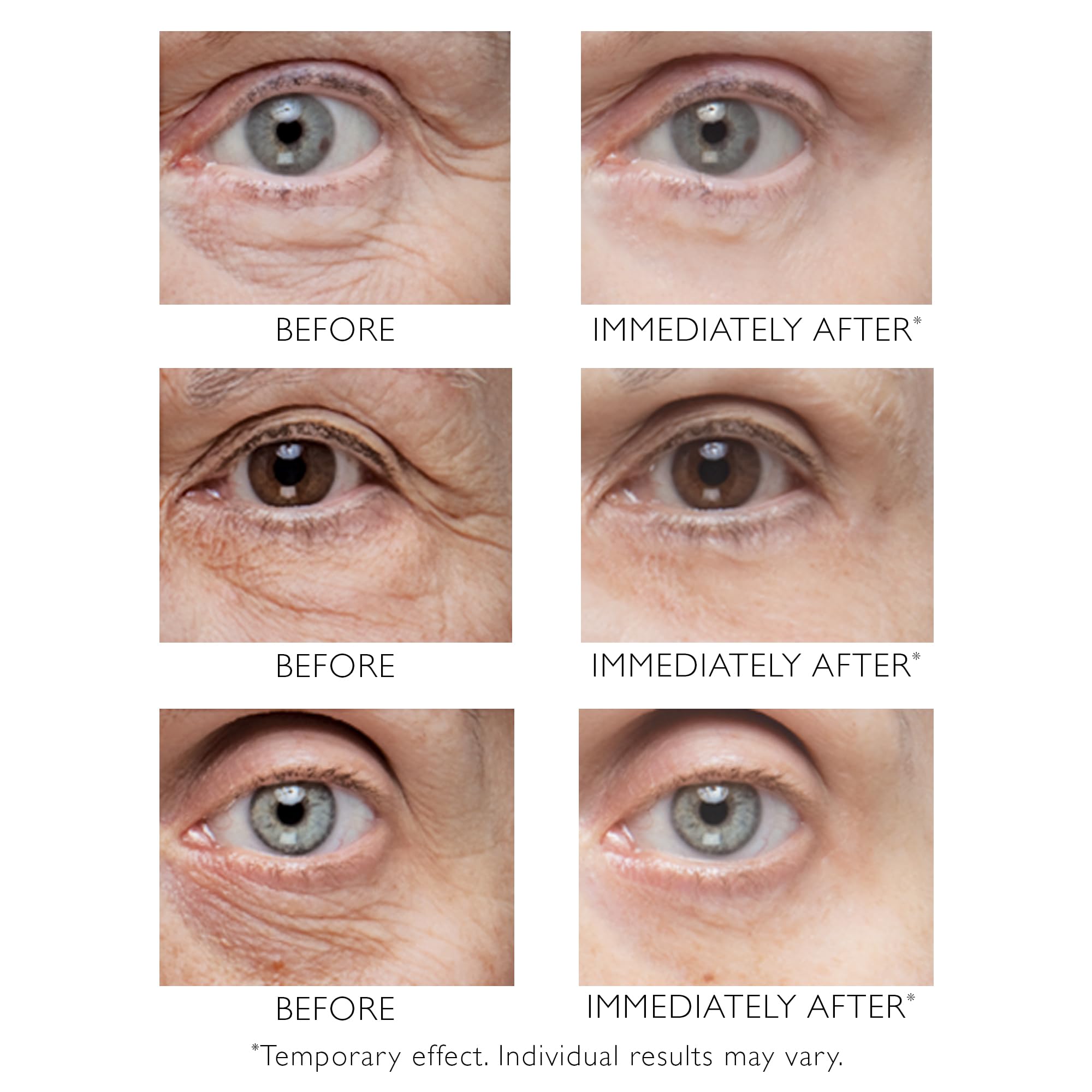 Peter Thomas Roth Instant FIRMx Eye Temporary Eye Tightener - Reduces Puffiness & Wrinkles | 15ml 4
