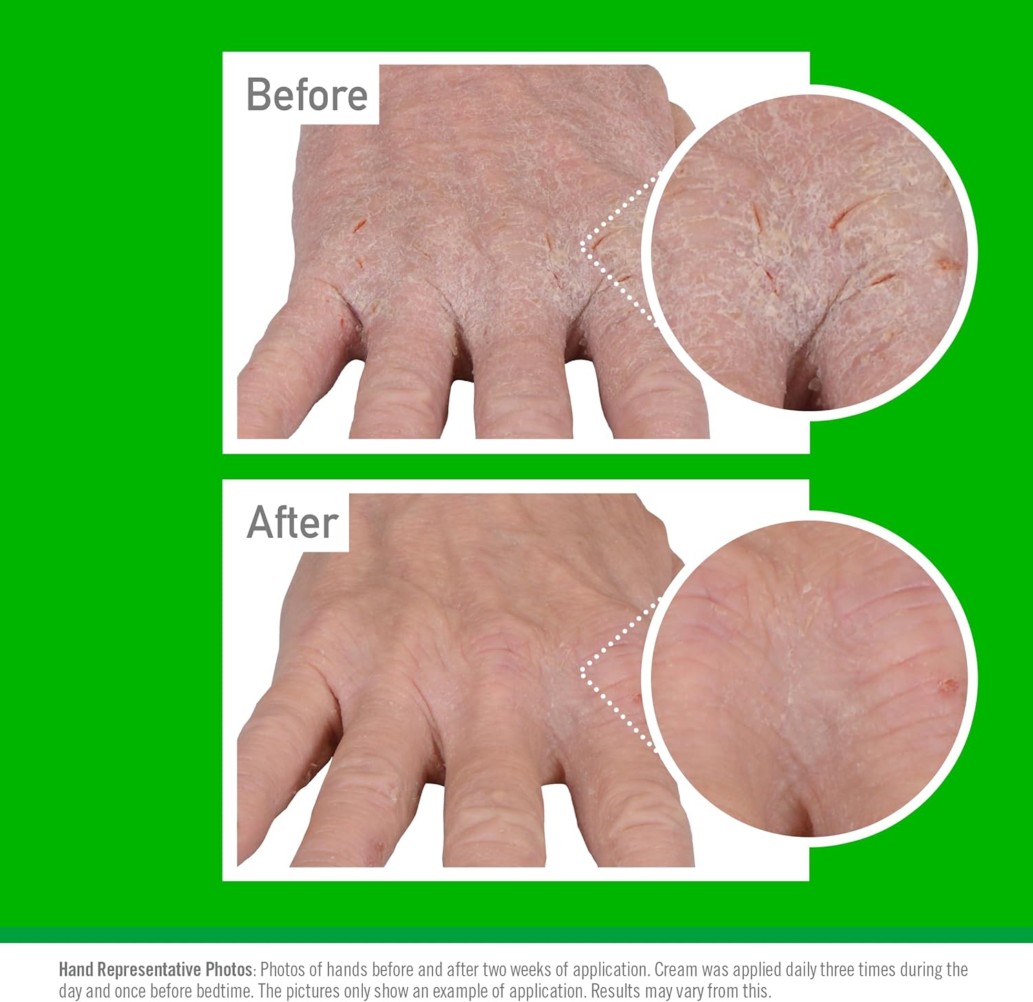 O'Keeffe's Working Hands Eczema Relief Hand Cream (57g) 3