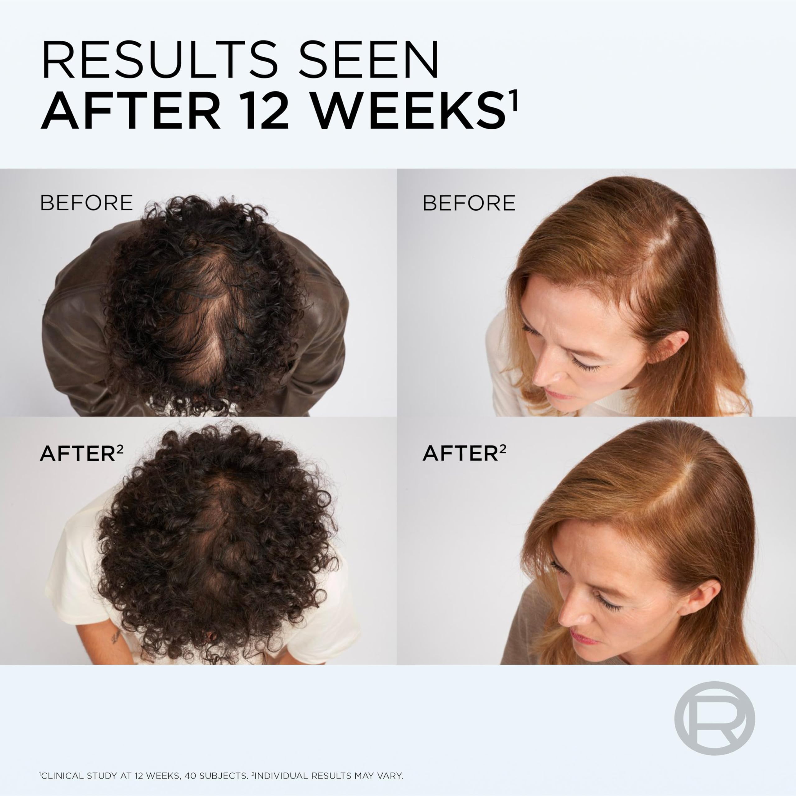 L'Oréal Paris Elvive Growth Booster Shampoo (200ml)