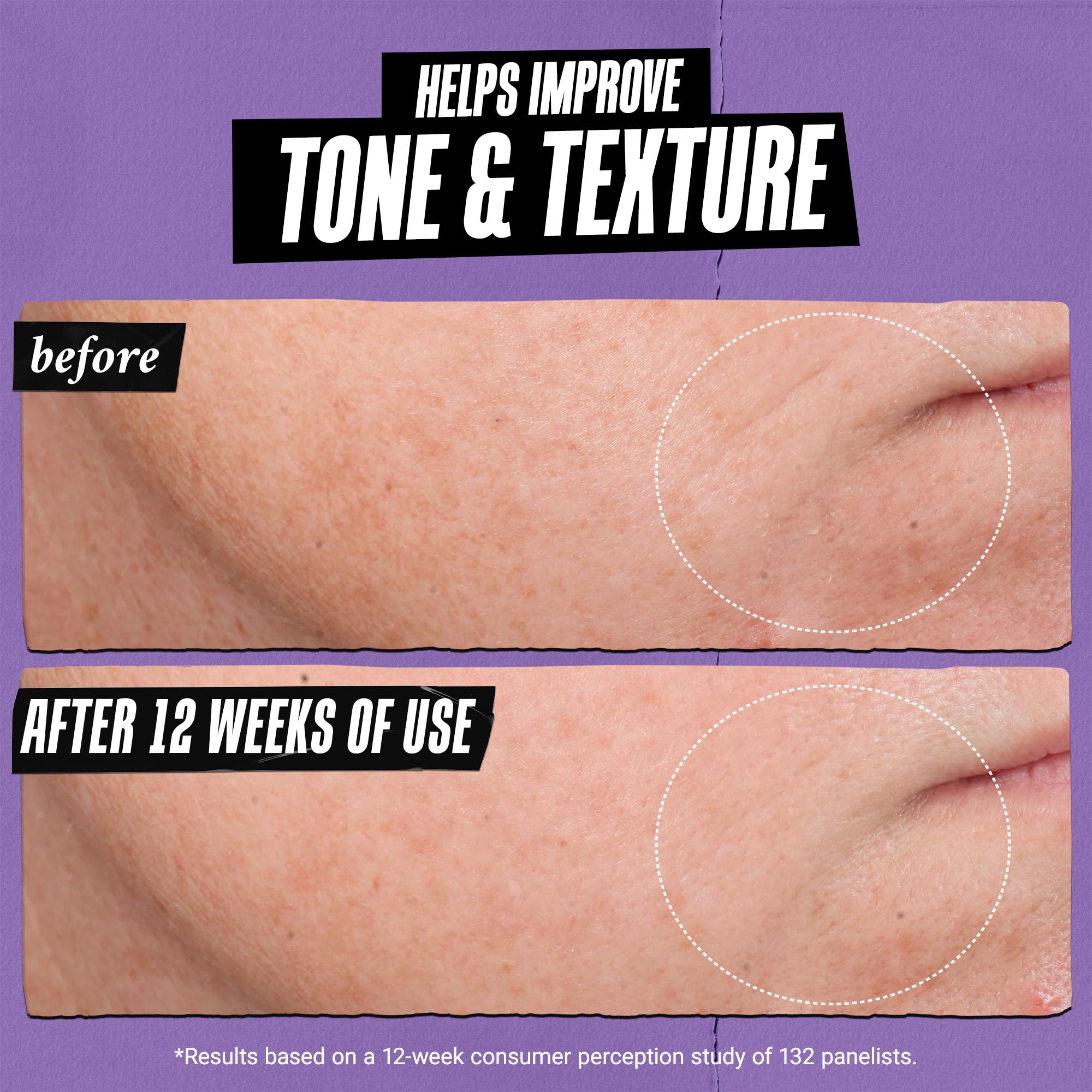 Kiehl's Retinol Skin-Renewing Daily Micro-Dose Serum - Reduces Wrinkles, Firms Skin | 50 ml 7